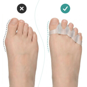Alternative view of OrthoRelax® – Separatore per Dita in Gel (2 separatori)