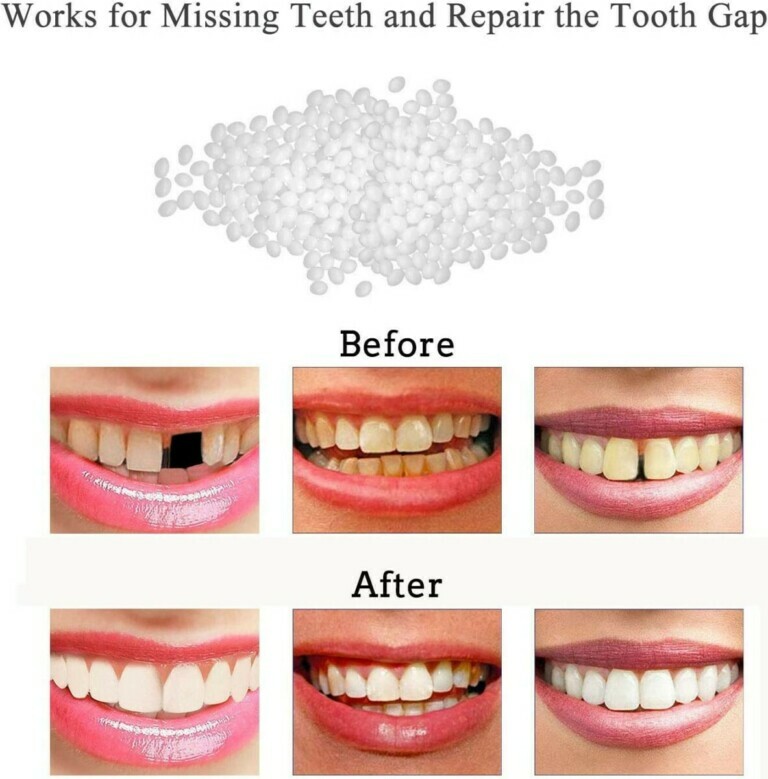 Set Denti Dorati In Rame Per Feste Hip Hop E Halloween - Decorazione Bling Con Cera Fissante