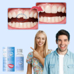 Kit per la Riparazione dei Denti InstaSmile